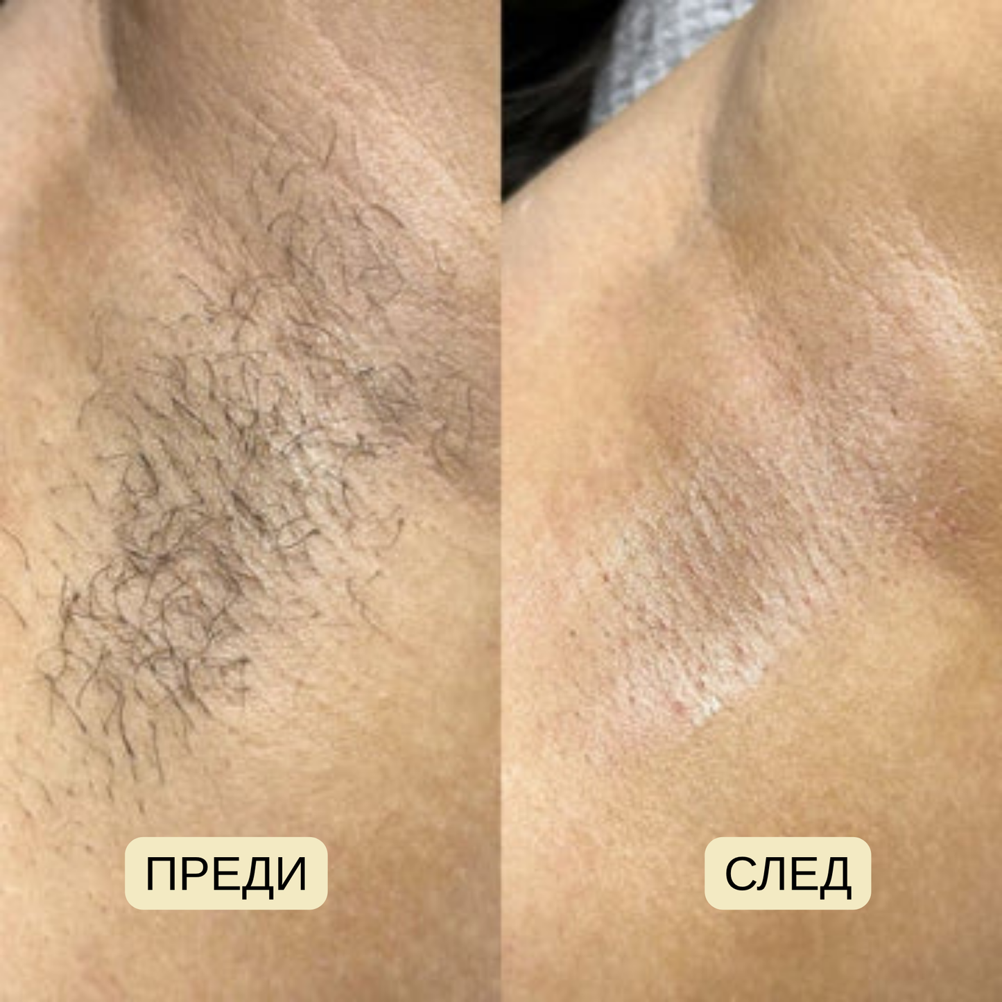 VELOUR. Масло Против Окосмяване