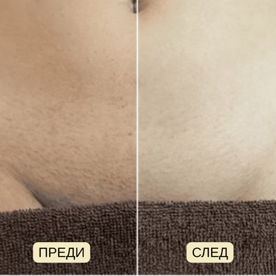VELOUR. Масло Против Окосмяване